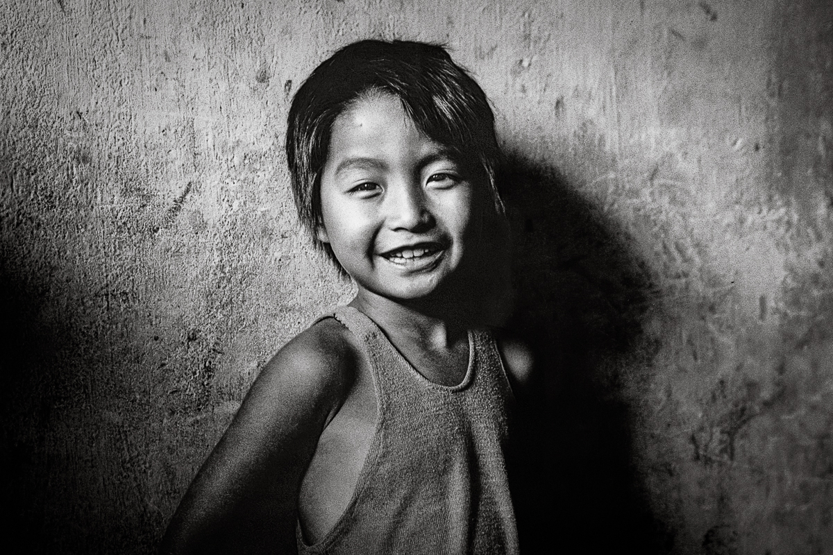 Young girl, Quy Hoa Leprosy Village, Quy Nhon, Vietnam. 6 Dec 1992
